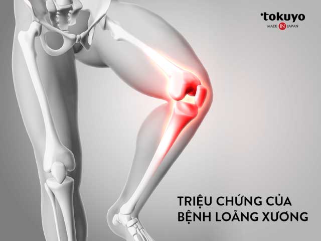 triệu chứng bệnh loãng xương